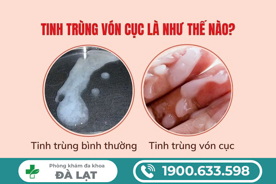 Hình ảnh minh họa